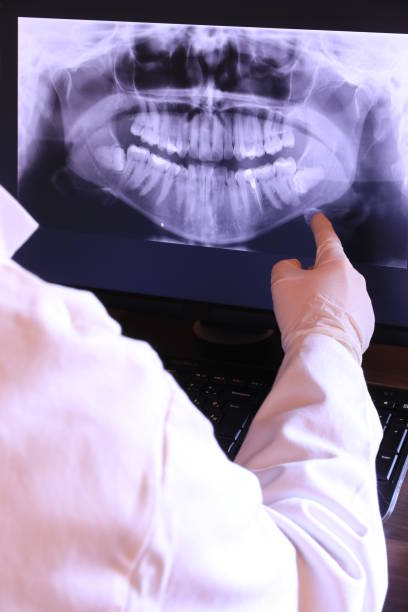 Best Emergency Treatment for Oral Infections in North Mankato, MN
